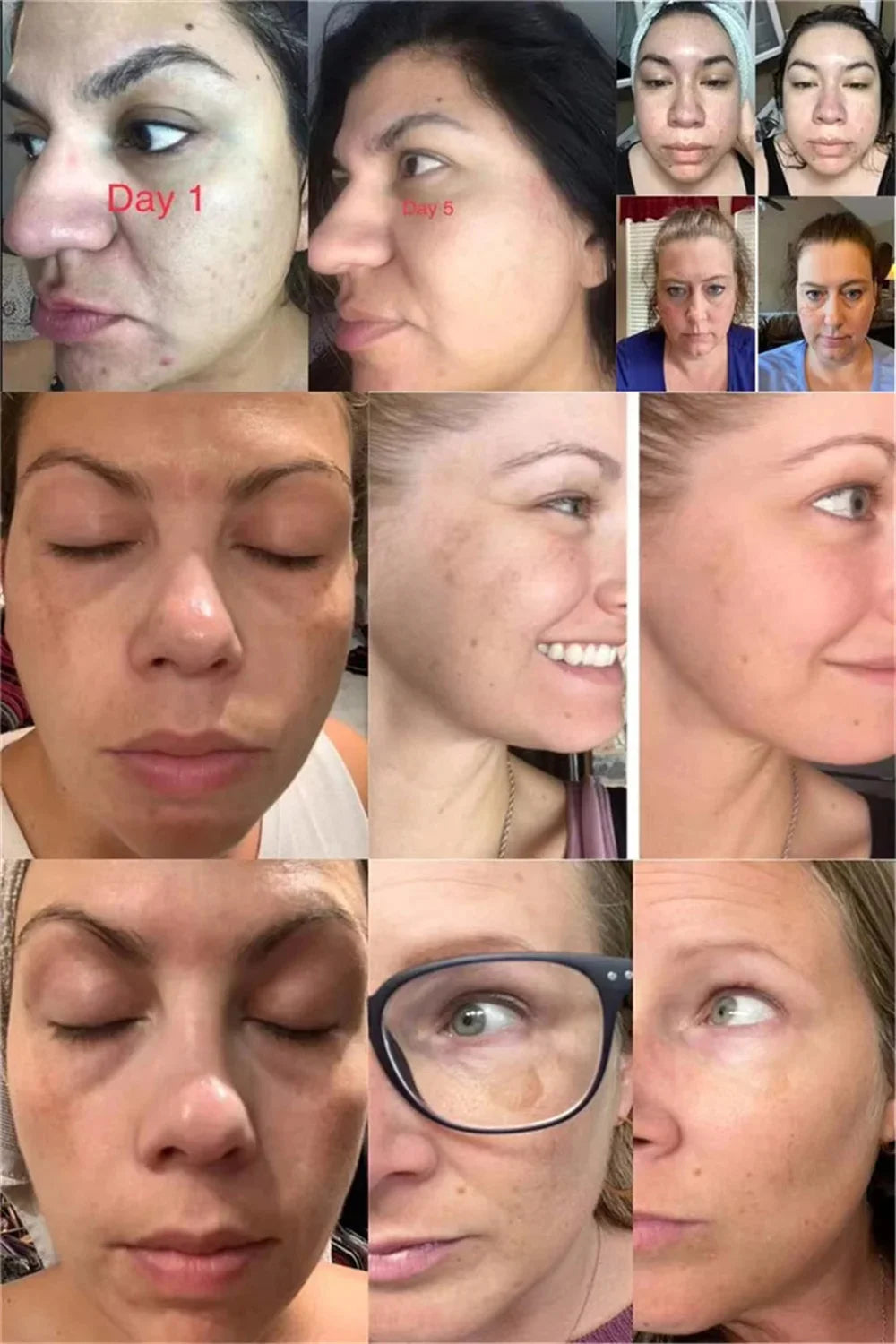 Spot-Removing Whitening Cream – Brighten & Fade Dark Spots