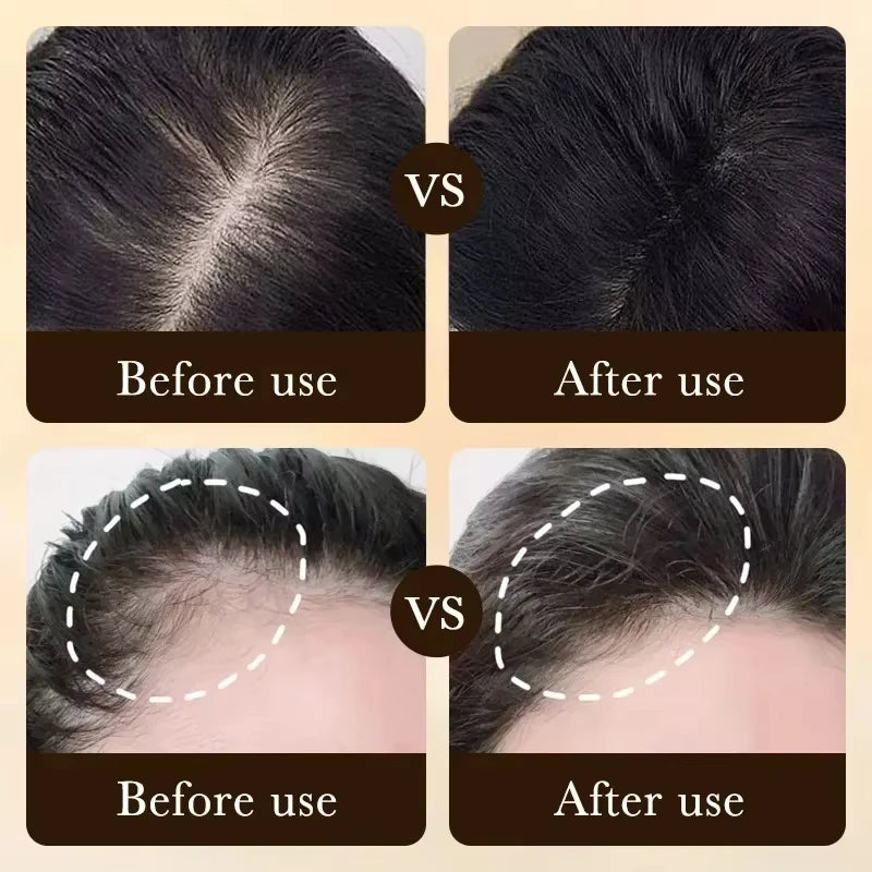 Hair Growth Treatment – Strengthen & Nourish Scalp