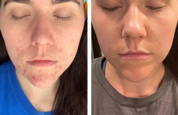 Beef Tallow Face Cream – Moisturizing & Skin Firming