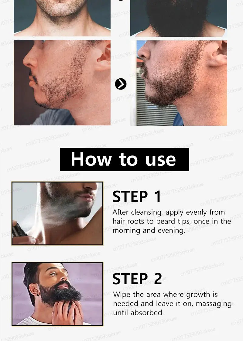 2025 Beard Growth Essence – Fast Hair Growth for Beard, Chest, Legs & Scalp