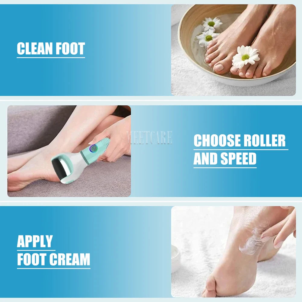 Electric Foot Grinder – Callus Remover & Pedicure Tool