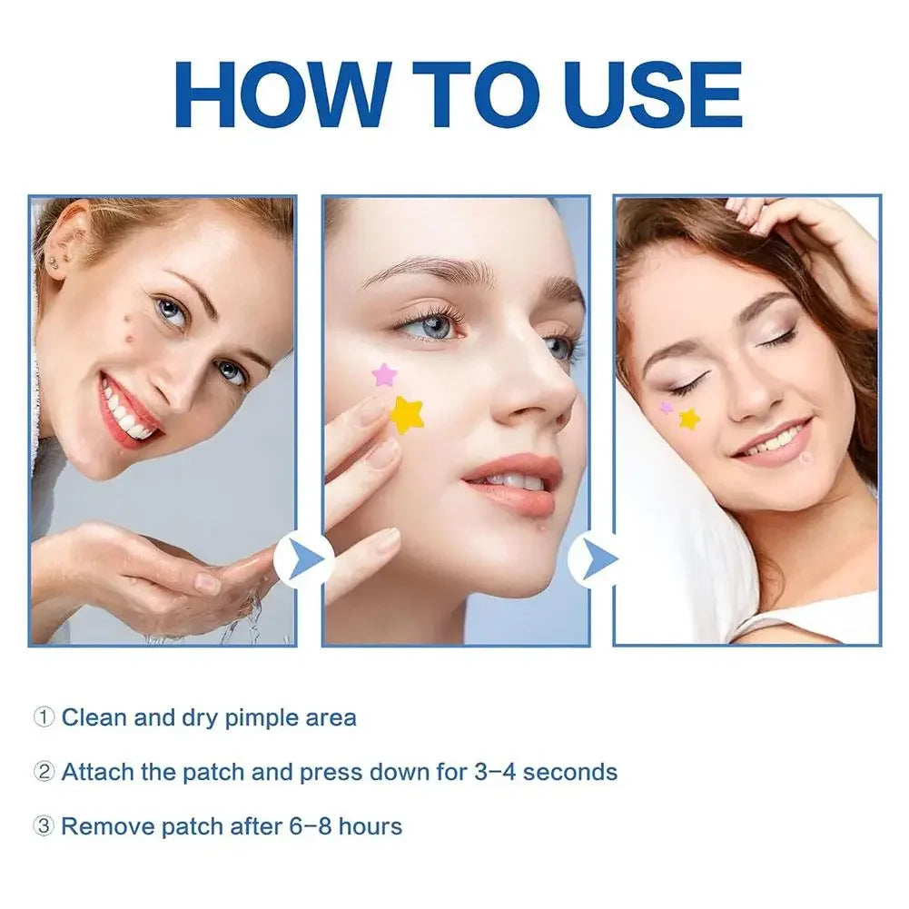 Colorful Star Pimple Patch – Acne Spot Concealer Stickers