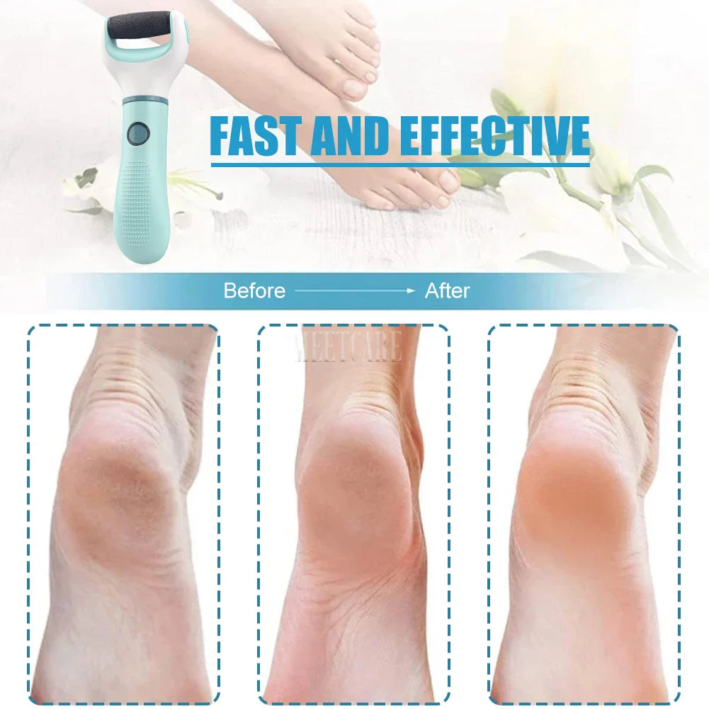 Electric Foot Grinder – Callus Remover & Pedicure Tool