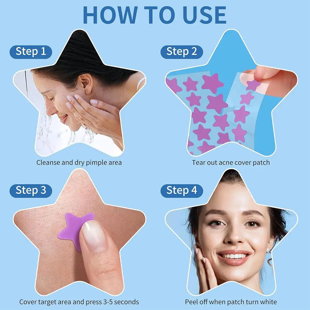 Colorful Star Pimple Patch – Acne Spot Concealer Stickers