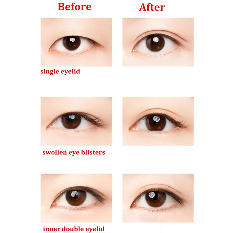 U N N Y Invisible Double Eyelid Tape – Beige