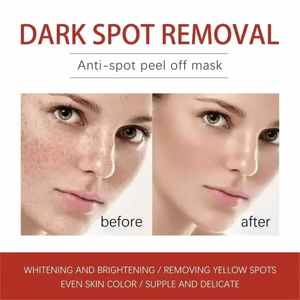 Spot-Removing Whitening Cream – Brighten & Fade Dark Spots
