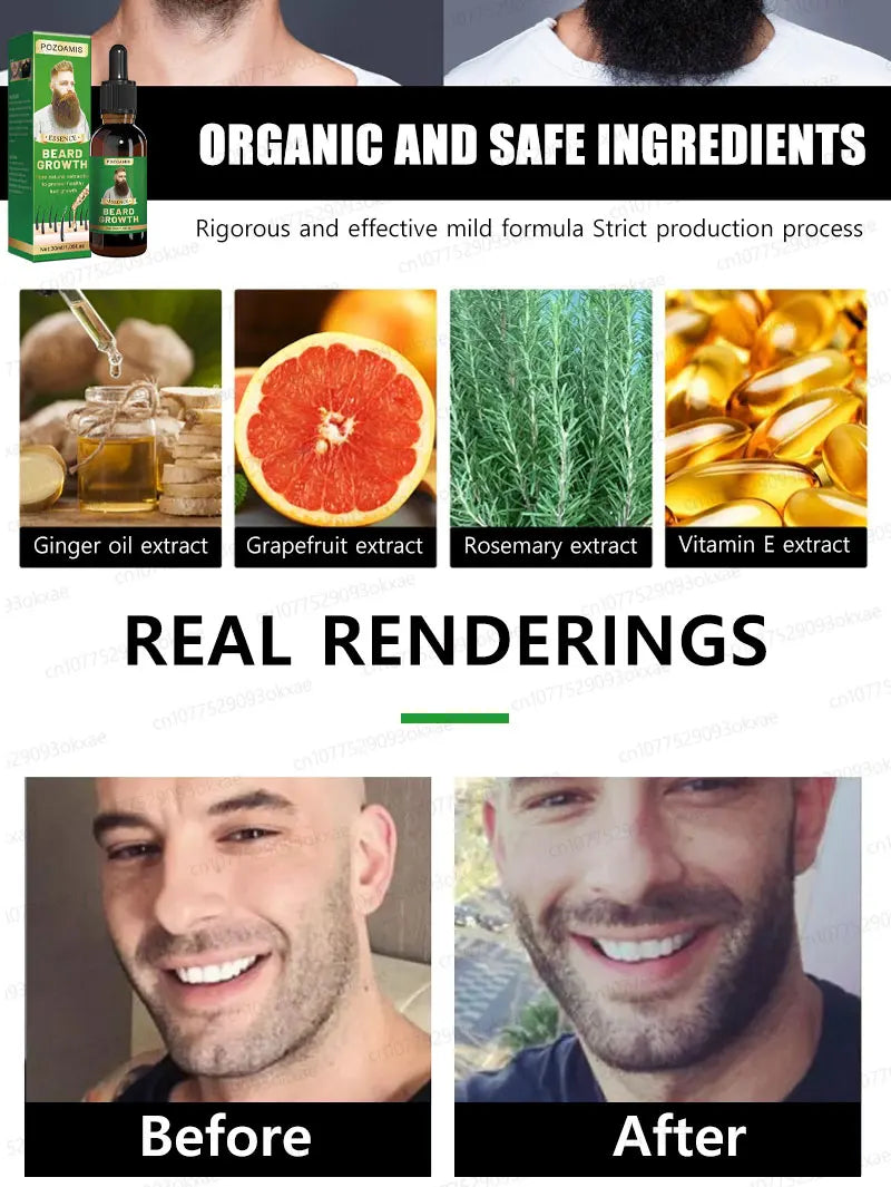 2025 Beard Growth Essence – Fast Hair Growth for Beard, Chest, Legs & Scalp