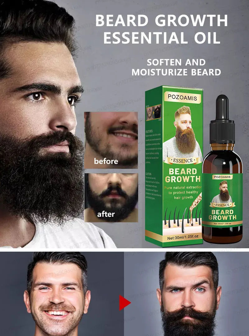 2025 Beard Growth Essence – Fast Hair Growth for Beard, Chest, Legs & Scalp