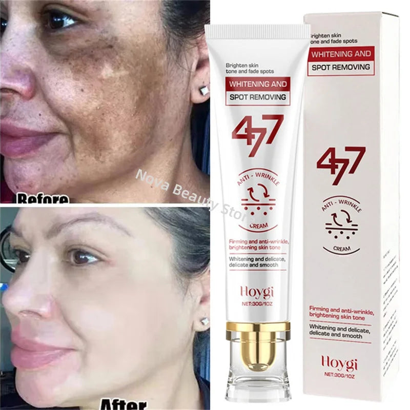 Spot-Removing Whitening Cream – Brighten & Fade Dark Spots