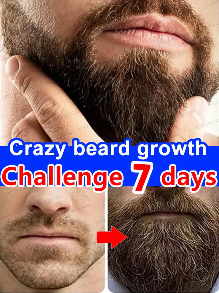 2025 Beard Growth Essence – Fast Hair Growth for Beard, Chest, Legs & Scalp