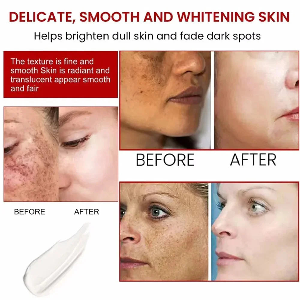 Spot-Removing Whitening Cream – Brighten & Fade Dark Spots